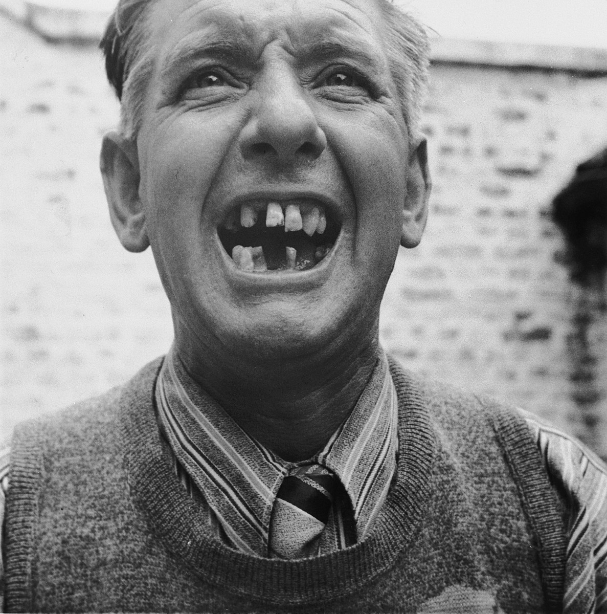 Emile Scieur displays his missing teeth as a result of torture received during his seventeen month imprisonment in the Breendonk internment camp